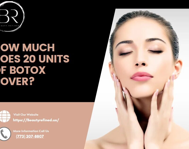 How Much Do 20 Units of Botox Cover?