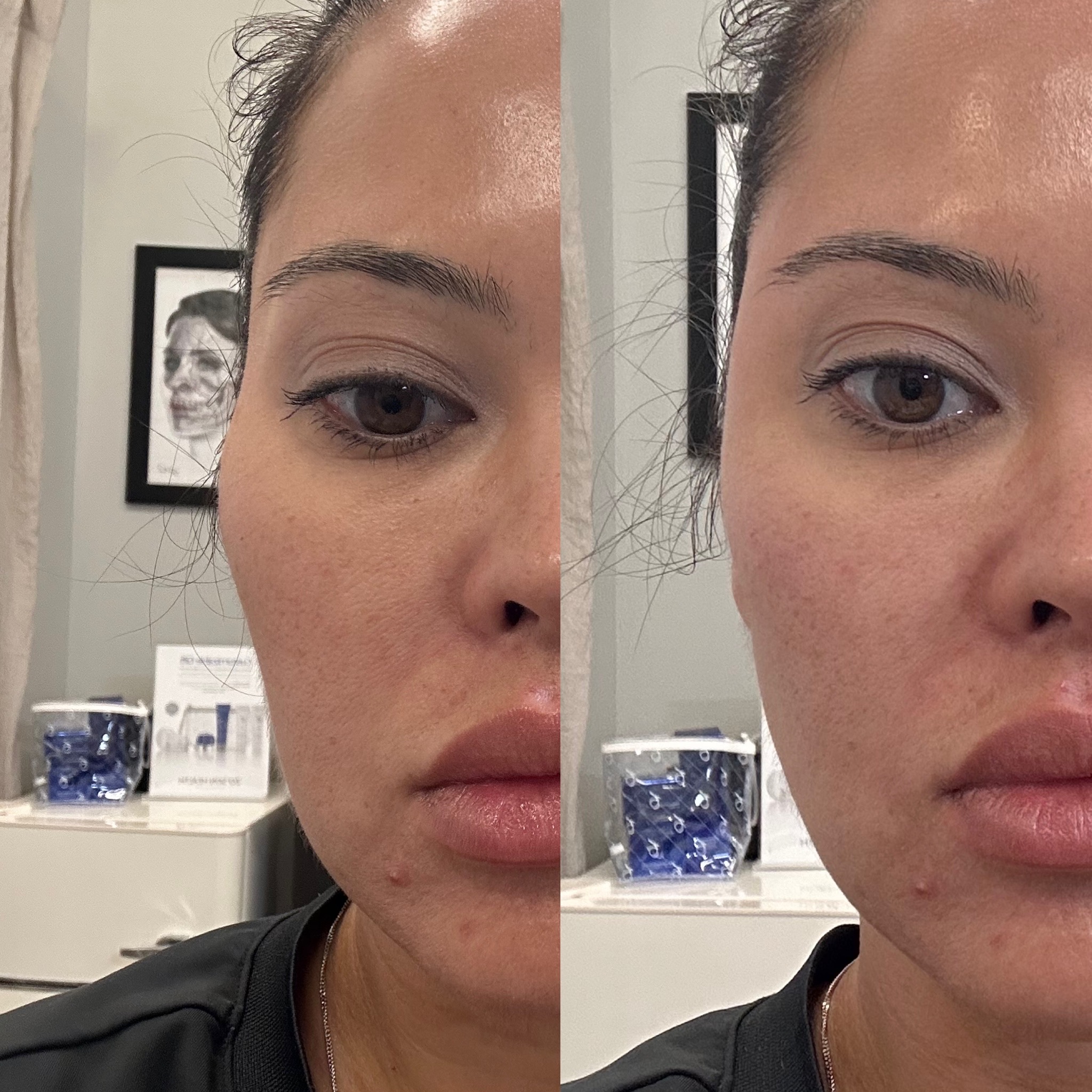 Experience Beauty Refined at Orlando's Premier Med Spa